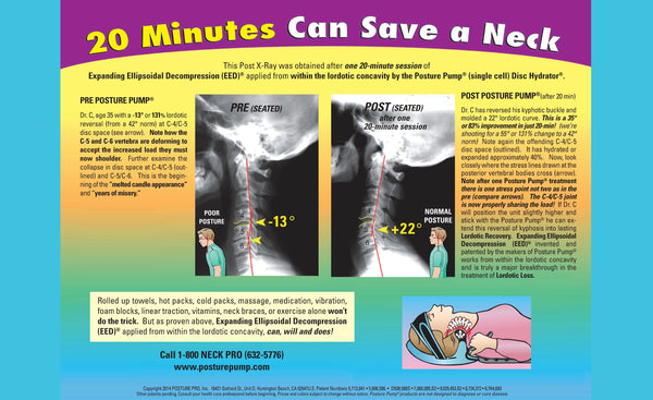 20 Minutes Can Save a Neck