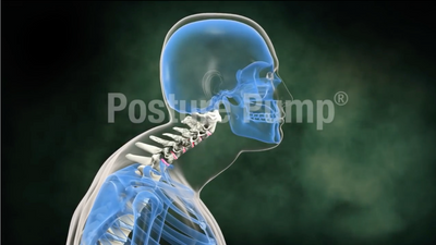 See What Frequent Texting/SmartPhone Use Can Do To Your Neck, & Watch How Posture Pump® Can Help