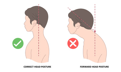 How To Correct Forward Neck Posture, AKA Nerd Neck