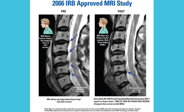 2006 irb goedgekeurde MRI-studie