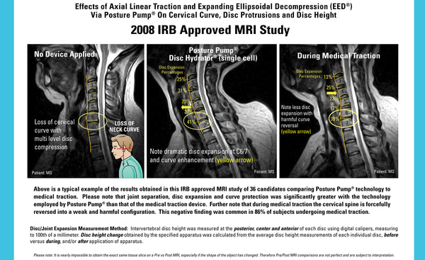 2008 vom IRB genehmigte MRT-Studie